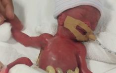 World's smallest known baby at birth, who weighed 7.5 ounces, leaves hospital