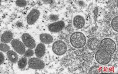 世卫组织：全球已有50个国家和地区确诊3400多例猴痘病例