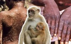 过去4个月泰国猴痘确诊病例达316例