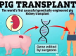 创纪录，基因编辑猪肾在人体“工作”271天