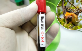 世卫组织：印度尼帕病毒传播风险低